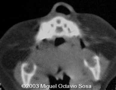 case0101-25