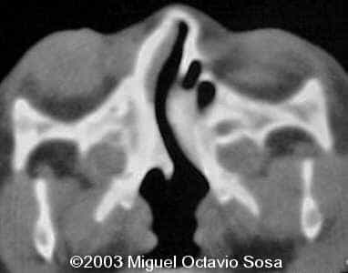 case0101-26