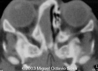 case0101-27