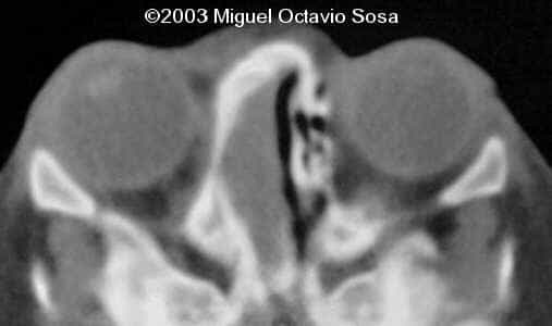 case0101-28