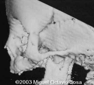 case0101-3