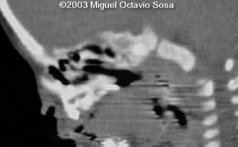 case0101-30