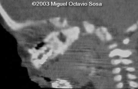 case0101-31