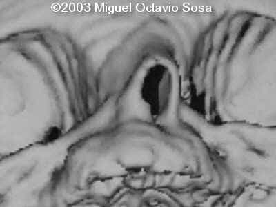 case0101-34