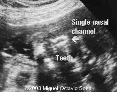 case0101-35