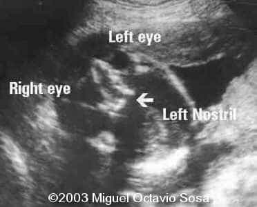 case0101-37