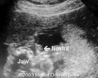case0101-39