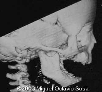 case0101-4