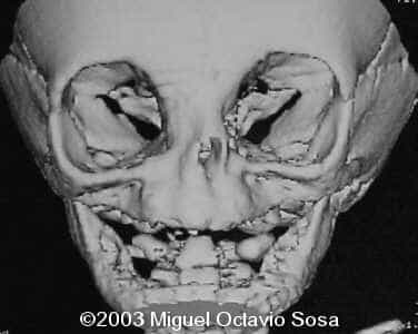 case0101-5