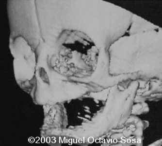 case0101-6