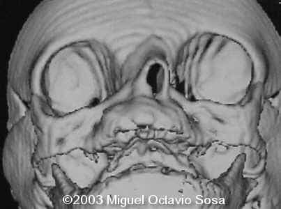 case0101-8