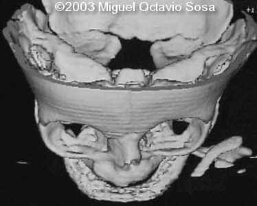 case0101-9
