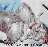 case0102-3