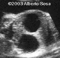 case0102-4