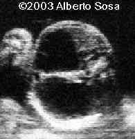 case0102-5