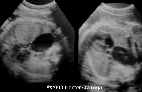 case0103-1