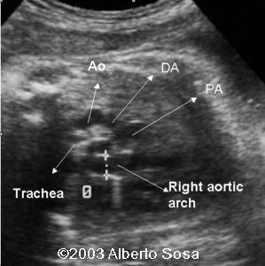case0104-1