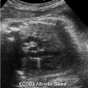 case0104-1a