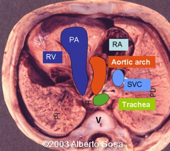 case0104-2