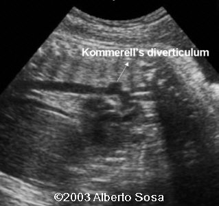 case0104-3