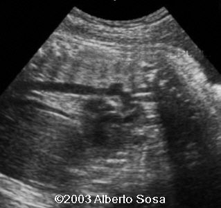 case0104-3a