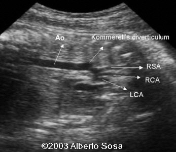 case0104-4