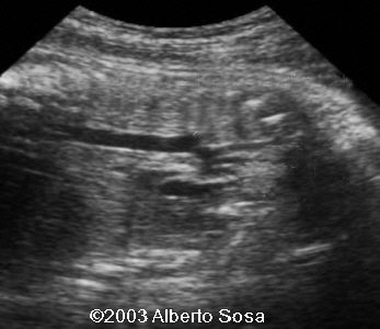 case0104-4a