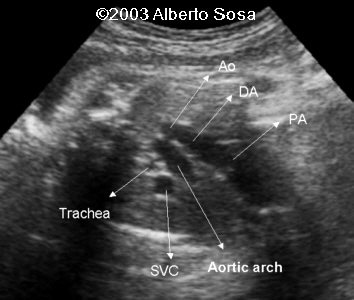 case0104-5