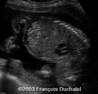 case0106-1