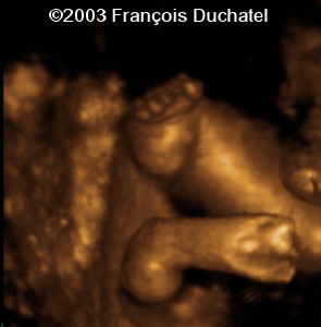 case0106-10