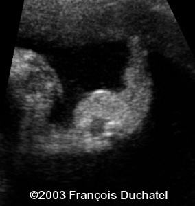 case0106-11
