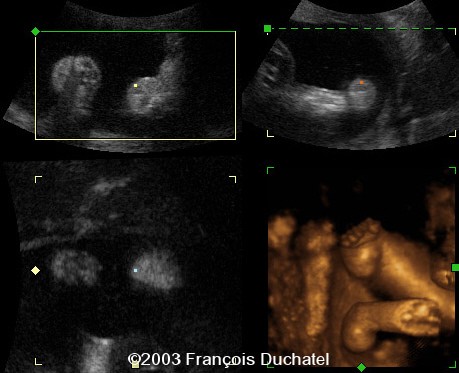 case0106-12