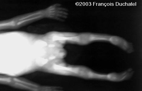 case0106-2