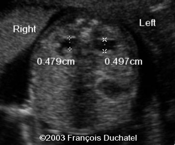 case0106-3