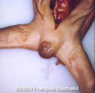 case0106-4