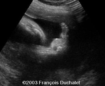 case0106-6