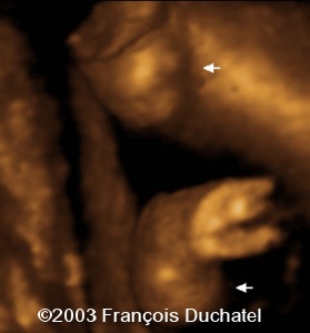 case0106-7