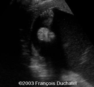 case0106-8