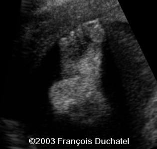 case0106-9
