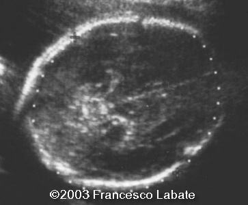case0107-1