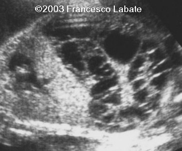 case0107-2