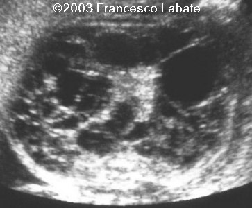 case0107-3