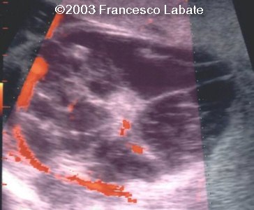 case0107-4