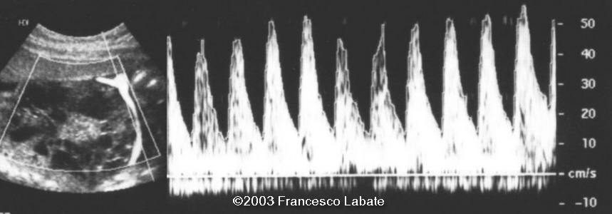 case0107-5
