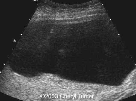 case0110-a