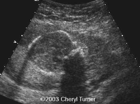 case0110-b