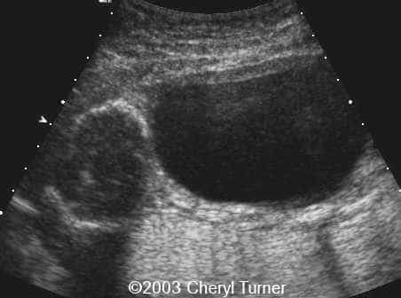 case0110-c