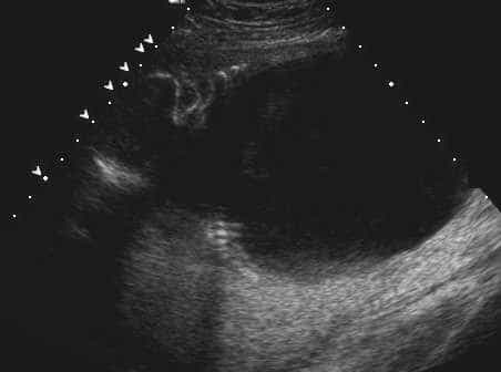 case0110-e