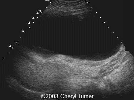 case0110-f