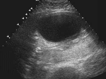case0110-h